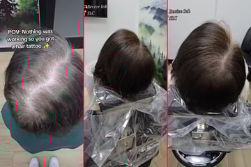 Woman reveals incredible scalp tattoo technique to help cover up hair loss