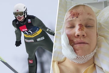 Halbes Jahr bettlägerig! Skispringer packt über Odyssee nach Horror-Sturz aus