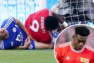 Große Sorge um Ex-Bundesliga-Star: Koma nach schlimmem Pfosten-Crash!