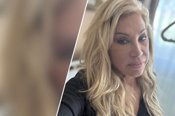 Carmen Geiss: Horror-Sturz in den eigenen vier Wänden: Carmen Geiss muss am Gehirn operiert werden