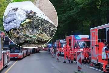 Hamburg: Feuer im Krankenhaus: Plötzlich brennt eine Matratze