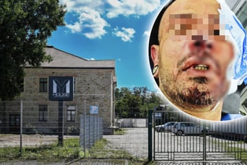 Dresden: Kommt der Täter aus Drogenmilieu? Partygast vor Dresdner Club niedergeschlagen