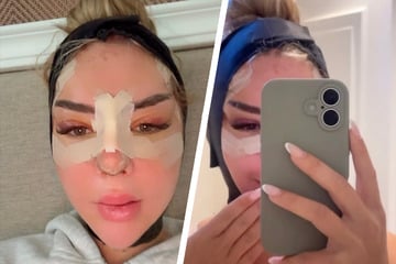 Emma Fernlund präsentiert zum ersten Mal ihr Gesicht nach Schönheits-OPs