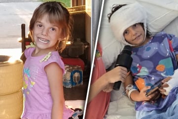 Von sechs Hunden skalpiert: Mädchen kommt schwer verletzt ins Krankenhaus