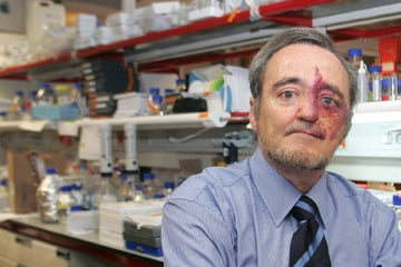 Durchbruch in der Krebsforschung? Arzt heilt aggressiven Tumor bei Mäusen