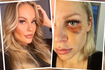 Influencerin macht Gewalt-Erfahrungen öffentlich: "Mein Lächeln kann mir niemand nehmen"