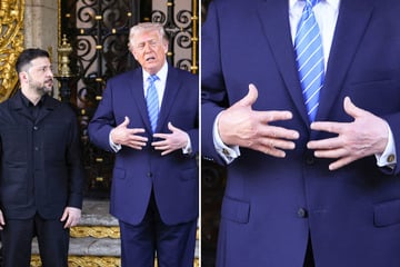 Trump spotted with fresh bruising on left hand, reviving questions over health