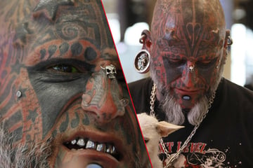 Body modification world record holder gets radical "serpent implants"