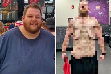 Mann nimmt mehr als 150 Kilo ab: Wie er jetzt aussieht, ist kaum zu glauben