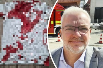 Blutiger Angriff auf AfD-Politiker! Partei hat Verdacht, wer dahintersteckt