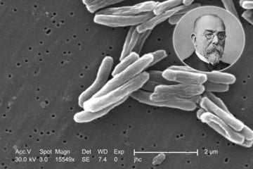 Heute vor 144 Jahren: Diese Entdeckung brachte Experten zum Schweigen und die Medizin voran