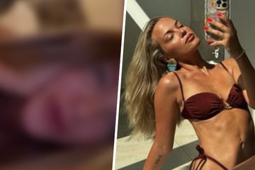 Laura Maria Rypa zeigt sich nach Beauty-Eingriff im Gesicht: "Ich find', ich wirke jünger"