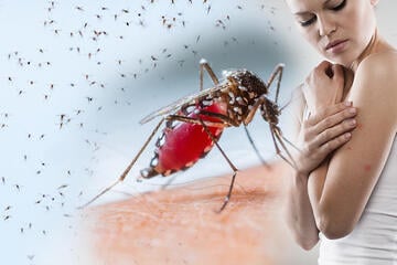 Euch hat's erwischt? Diese 10 Hausmittel helfen gegen Mücken-Stiche