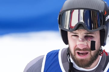 Olympia 2026 im Ticker: Nach Sturz schwer gezeichnet, doch Ski-Ass startet trotzdem