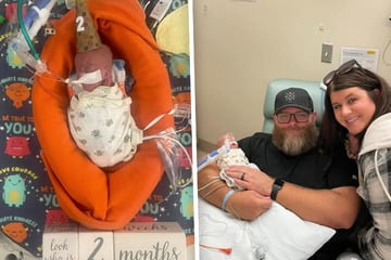 Kaum Überlebenschancen: Baby kommt 19 Wochen zu früh! Nicht zu glauben, wie es ein Jahr später aussieht