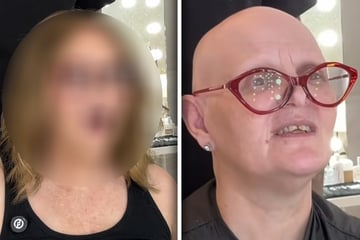 Frau mit Glatze will endlich wieder volles Haar: Nach Makeover ist sie wie erschlagen