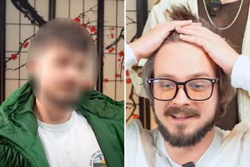 Mann hasst seine hohe Stirn: Doch nach Umstyling ist er nicht wiederzuerkennen