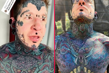 Will extreme tattoo addict Remy black out all of his ink?