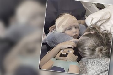 Junge (5) unterzieht sich Schönheits-OP und fühlt sich danach endlich wohl