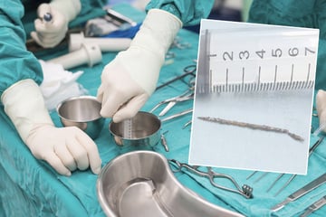 Schock bei Untersuchung: Ärzte finden Nadeln in Herz und Penis eines Patienten