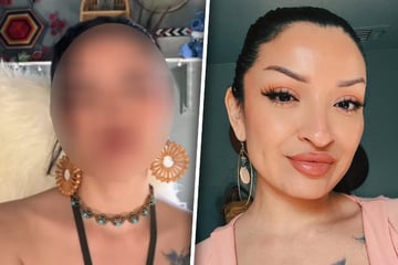 Frau erfüllt sich mit Nasen-OP Lebenstraum: Als sie das Ergebnis sieht, ist sie sprachlos