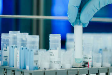 Apothekerverband fordert Ende der PCR-Testpflicht in NRW