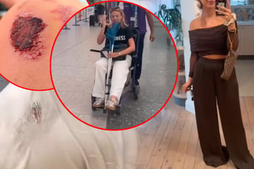 Tödliche Zara-Hose? Kundinnen berichten weltweit von teilweise heftigen Verletzungen