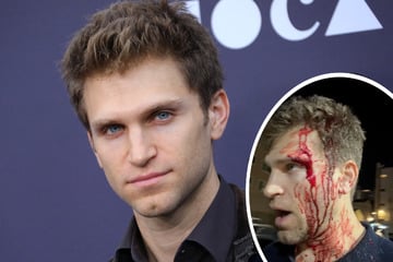 "Pretty Little Liars"-Star blutüberströmt: "Sie drohten, mich zu töten"