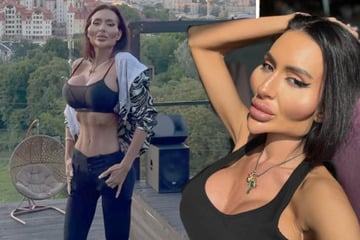 Frau mit XXL-Wangen schockt mit Fotos von früher