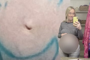 Schwangere wird in Kreißsaal eingeliefert: Was die Hebammen dann auf ihrem Bauch erblicken, hat keiner erwartet