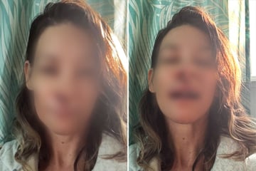 Sturz auf Felsbrocken: Hollywood-Star erleidet dramatische Hirnschäden