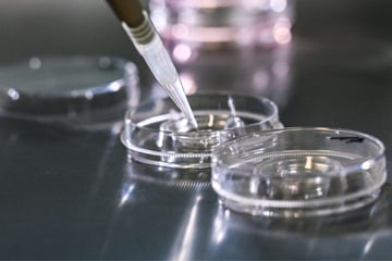 Frau bekommt in Italien falschen Embryo eingesetzt