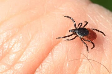 Berlin: Zecken-Alarm in Berlin: Immer mehr Borreliose-Fälle in der Hauptstadt
