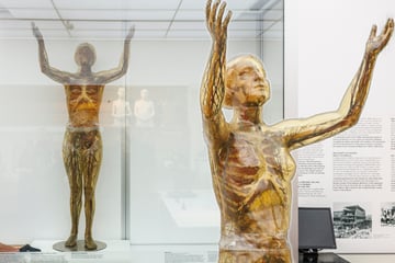 Dresden: Sie ist wieder da! Gläserne Frau erhält eigene Vitrine mit Klimaanlage