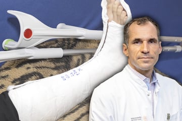 Dresden: Pünktlich zum Tauwetter: Knochenknack-Bilanz der Uniklinik