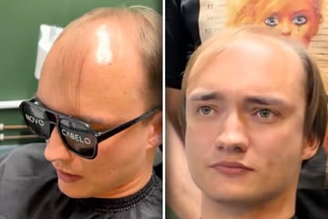 28-Jähriger leidet unter Glatze: Als er sich nach Umstyling sieht, traut er seinen Augen nicht