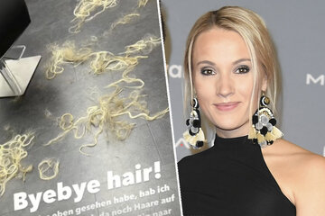 Deshalb fallen bei Ex-Bachelorette Anna Hofbauer die Haare!