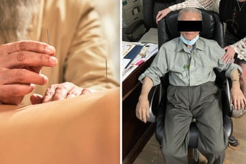 Soll Patientin mit Nadeln gefügig gemacht haben: Akupunktur-Heiler (91) nach Sex-Übergriff angeklagt