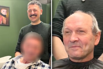 Mann will endlich wieder volles Haar: Beim Ergebnis traut er seinen Augen nicht