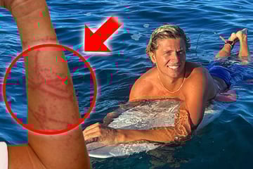Schock im Meer: Surfer von tödlicher Qualle getroffen