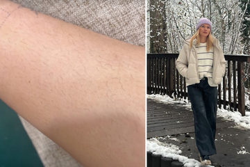 Sara Kulka erntet Kritik für stoppelige Beine: "Bei Männern finde ich: je haariger, desto besser"