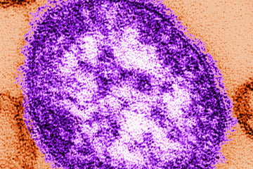 WHO schlägt Alarm: Diese Infektionskrankheit ist massiv auf dem Vormarsch