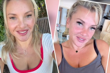 Evelyn Burdecki: Evelyn Burdecki offenbart Schönheitsfehler: Darunter hat sie jahrelang gelitten