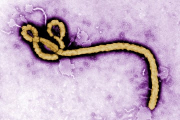 Ebola-Alarm in Tschechien: Mann nach Afrika-Reise isoliert
