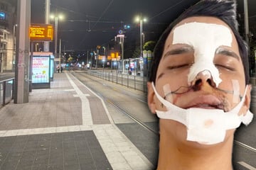 Leipzig: Hetzjagd nach Partynacht in Leipzig: "Sie haben mich ohnmächtig geschlagen!"