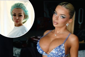 "Damit ich noch geiler aussehe": Katja Krasavice lässt sich Rippe für Beauty-OP entfernen