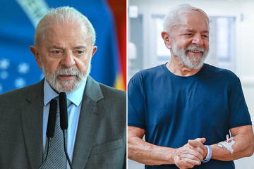 Brazilian President Lula shares big update after emergency surgery