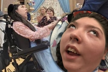 Ärzte gaben ihr damals nur ein paar Monate: Frau lebt seit 20 Jahren beinahe komplett ohne Gehirn