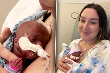 Mutter will nur noch Abschied von 24-Wochen-Frühchen nehmen: Doch sie macht einen Fehler