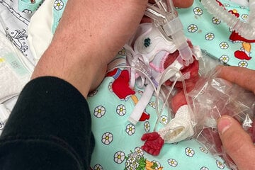 Mini-Baby mit 265 Gramm geboren: So geht es dem winzigen Wunder